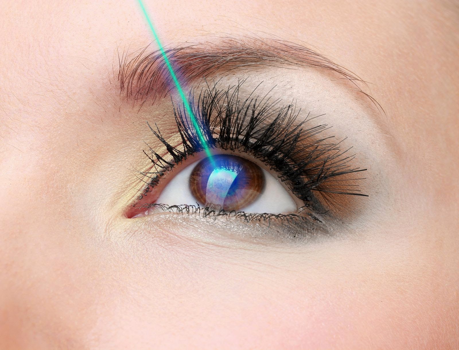 CIRUGIA REFRACTIVA OPTILASER